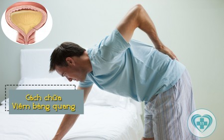 CÁCH CHỮA BỆNH VIÊM BÀNG QUANG